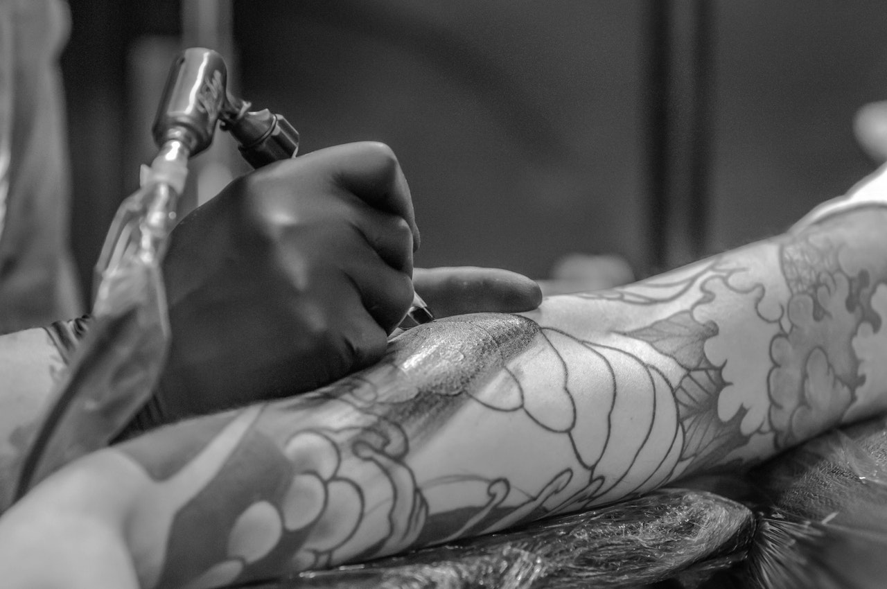 Laserowe usuwanie tatuażu – odpowiadamy na najczęściej zadawane pytania